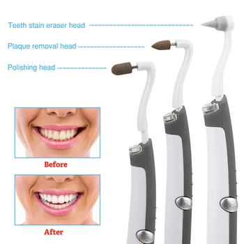 Elétrica Ultra-Sônica de Vibração Acústica de Dente mais limpo Escalonamento de Dente Cálculo Removedor de Manchas dos Dentes Tártaro Clareamento dos dentes