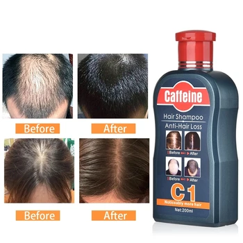 Perda do Anti-cabelo Shampoo 200ml Deep Repair Condicionador Nutritivo Óleo Limpo e Café envios rapidos y gratis do shampoo e condicionador